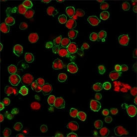 CD45 Antibody (Leukocyte marker)
