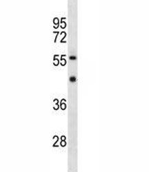 YY1 Antibody