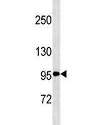 CD30 antibody western blot analysis in K562 lysate. Predicted molecular weight: 53-120 kDa depending
