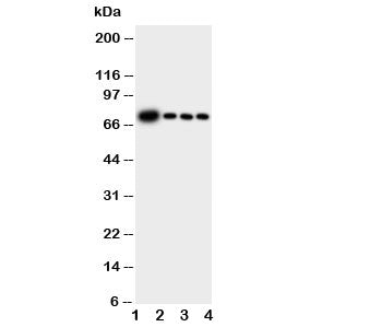 Western blot testing of GCLC antibody and Lane 1: rat brain; 2: rat kidney; 3: rat heart; 4: rat lun