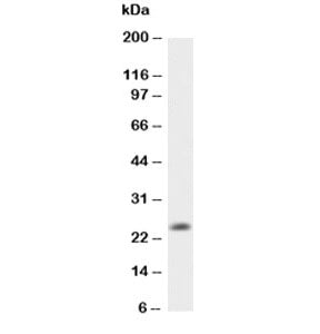 IL-6 Antibody