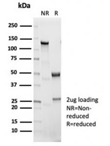 SDS-PAGE analysis of purified, BSA-free recombinant IL1 beta antibody (clone IL1B/7049R) as confirma