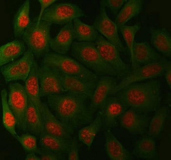 Immunofluorescent staining of FFPE human HeLa cells with XPA antibody (red) and Beta Tubulin mAb (gr