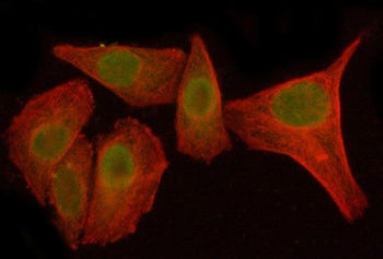 IKBZ Antibody / IKB zeta / NFKBIZ
