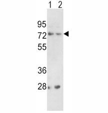PCSK2 Antibody
