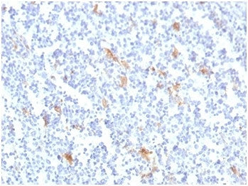 IHC staining of FFPE human tonsil tissue with SPARC antibody (clone OSTN/3759). HIER: boil tissue se