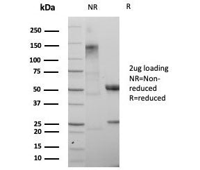 SATB2 Antibody