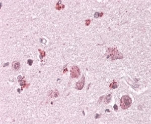 IHC testing of FFPE human cortex with Chimaerin 2 antibody at 4ug/ml. HIER: steamed with pH6 citrate