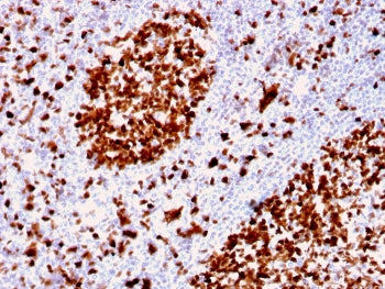 IHC staining of FFPE human tonsil with MCM6 antibody. HIER: boil tissue sections in pH 9 10mM Tris w