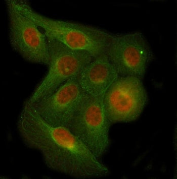 PPP1R35 Antibody / Protein phosphatase 1 regulatory subunit 35 / C7orf47