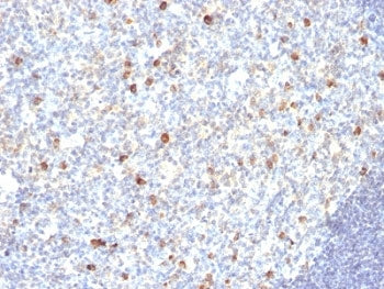 IHC: Formalin-fixed, paraffin-embedded human tonsil stained with anti-IgM antibody (SPM188).