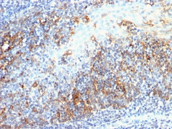 IHC staining of FFPE human tonsil with Cdc20 antibody (clone AR12). HIER: boil tissue sections in pH