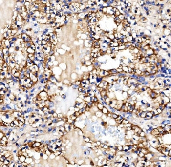 Glycogen synthase 1 Antibody / GYS1