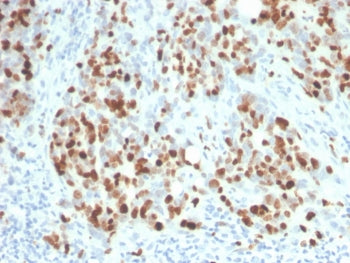 IHC staining of FFPE human lymph node with recombinant Ki67 antibody (clone rMKI67/6615). HIER: boil