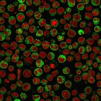 CD79a Antibody