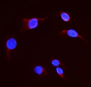 DHFR Antibody