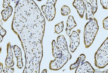 IHC staining of FFPE human placental tissue with MOV10 antibody. HIER: boil tissue sections in pH8 E