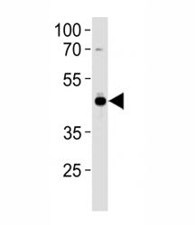 AP2 Antibody