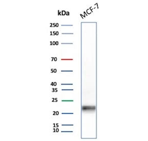 Western blot testing of human MCF7 cell lysate with MGMT antibody. Predicted molecular weight: ~23 k