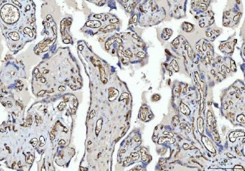 IHC staining of FFPE human placental tissue with CD31 antibody. HIER: boil tissue sections in pH8 ED