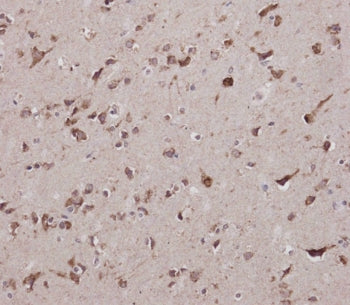 CBS Antibody / Cystathionine Beta Synthase