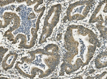 FABP6 Antibody / Gastrotropin