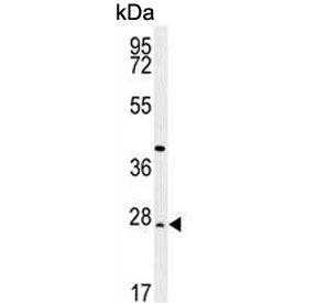DIRAS3 Antibody