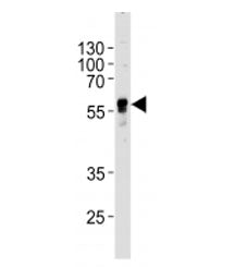 Western blot analysis of lysate from human SH-SY5Y cell line using ABHD3 antibody at 1:1000 for each