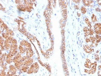 Beta Catenin Antibody