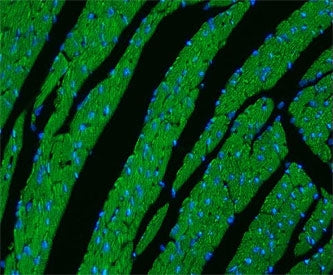 Immunofluorescent staining of FFPE mouse heart tissue with CPT1B antibody (green) and DAPI nuclear s