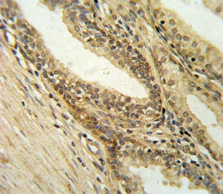 DFFB Antibody