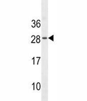 EPO Antibody