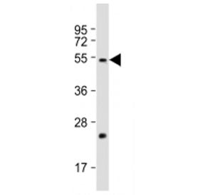 FADS2 Antibody