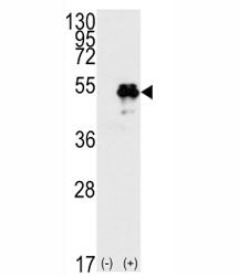 TP53 Antibody (p53)