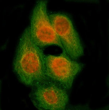 Immunofluorescent staining of FFPE human HeLa cells with RBM14 antibody (red) and Alpha Tubulin mAb 