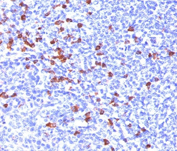 IHC testing of human tonsil stained with anti-IgG antibody (IG266). HIER: boil tissue sections in 10