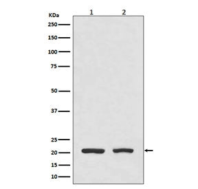 Western blot testing of 1) human HeLa cell lysate and 2) mouse spleen lysate with DHFR antibody. Exp
