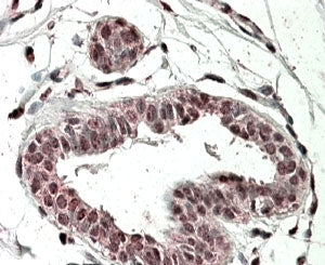 TREX2 Antibody