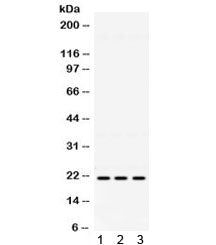 Western blot testing of 1) mouse brain, 2) human HeLa and 3) human A549 lysate with HRAS antibody. E