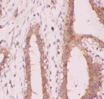 NFKB2 Antibody