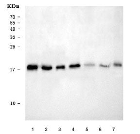 Western blot testing of 1) rat liver, 2) rat pancreas, 3) rat NRK, 4) mouse liver, 5) mouse pancreas