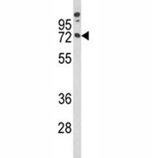 Western blot analysis of MAG antibody and A375 lysate