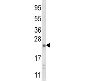 Western blot analysis of NQO2 antibody and mouse liver tissue lysate. Predicted molecular weight ~26