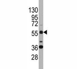 SOX9 Antibody