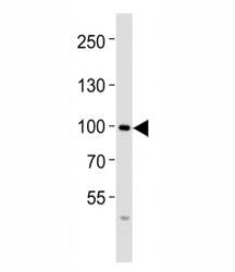 Western blot analysis of lysate from SW480 cell line using FGFR4 antibody at 1:1000. Observed molecu