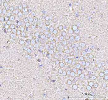 PPP3R1 Antibody / Calcineurin B