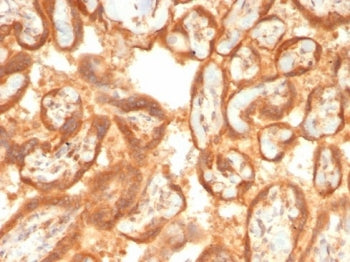 VEGF Antibody / Vascular Endothelial Growth Factor