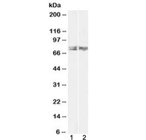 LIM Kinase 2 Antibody / LIMK2