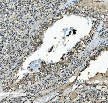 MAP2K2 Antibody / MEK2