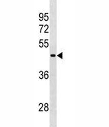 RBMY1A1 Antibody